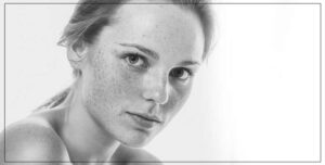 Ovale du Visage acide hyaluronique Pontoise