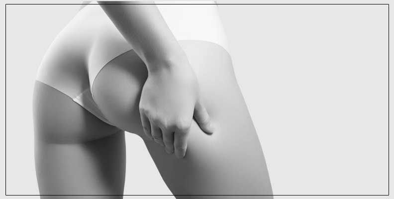 Traitement de la Cellulite Dr MAteo Delamarre Pontoise