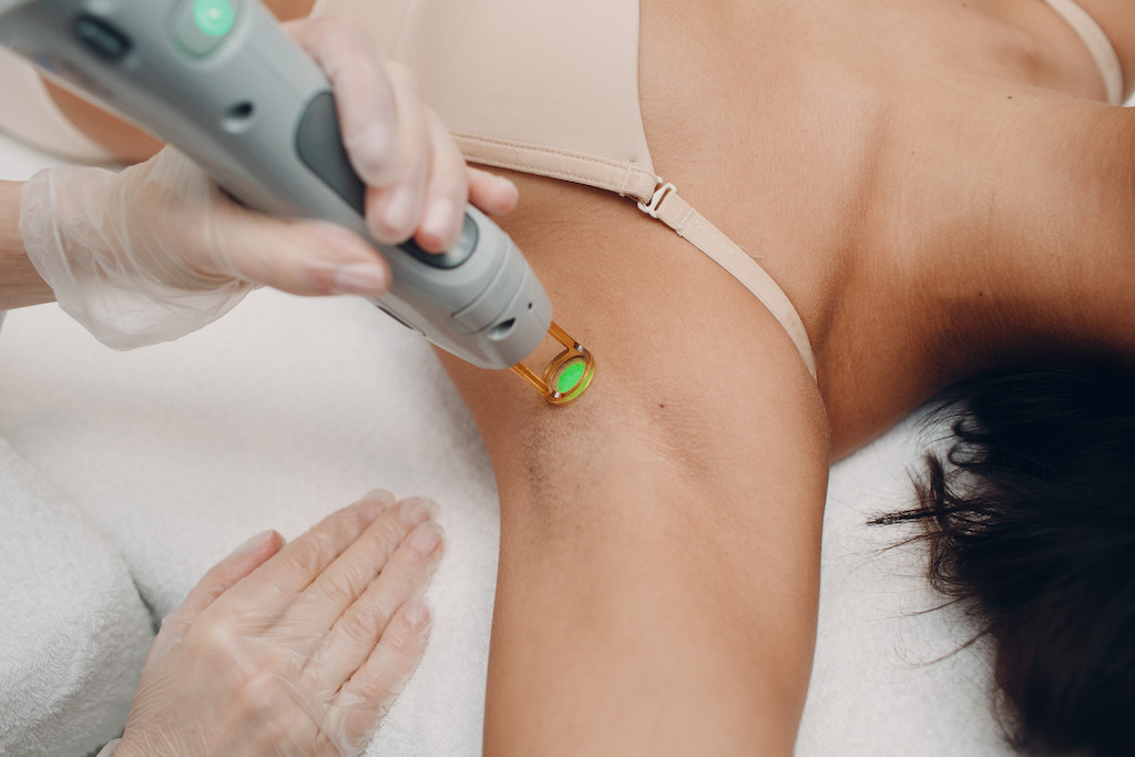 Epilation laser, éliminer les poils indésirables à Pontoise