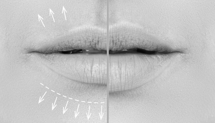 Lèvres pulpeuses plus de volume